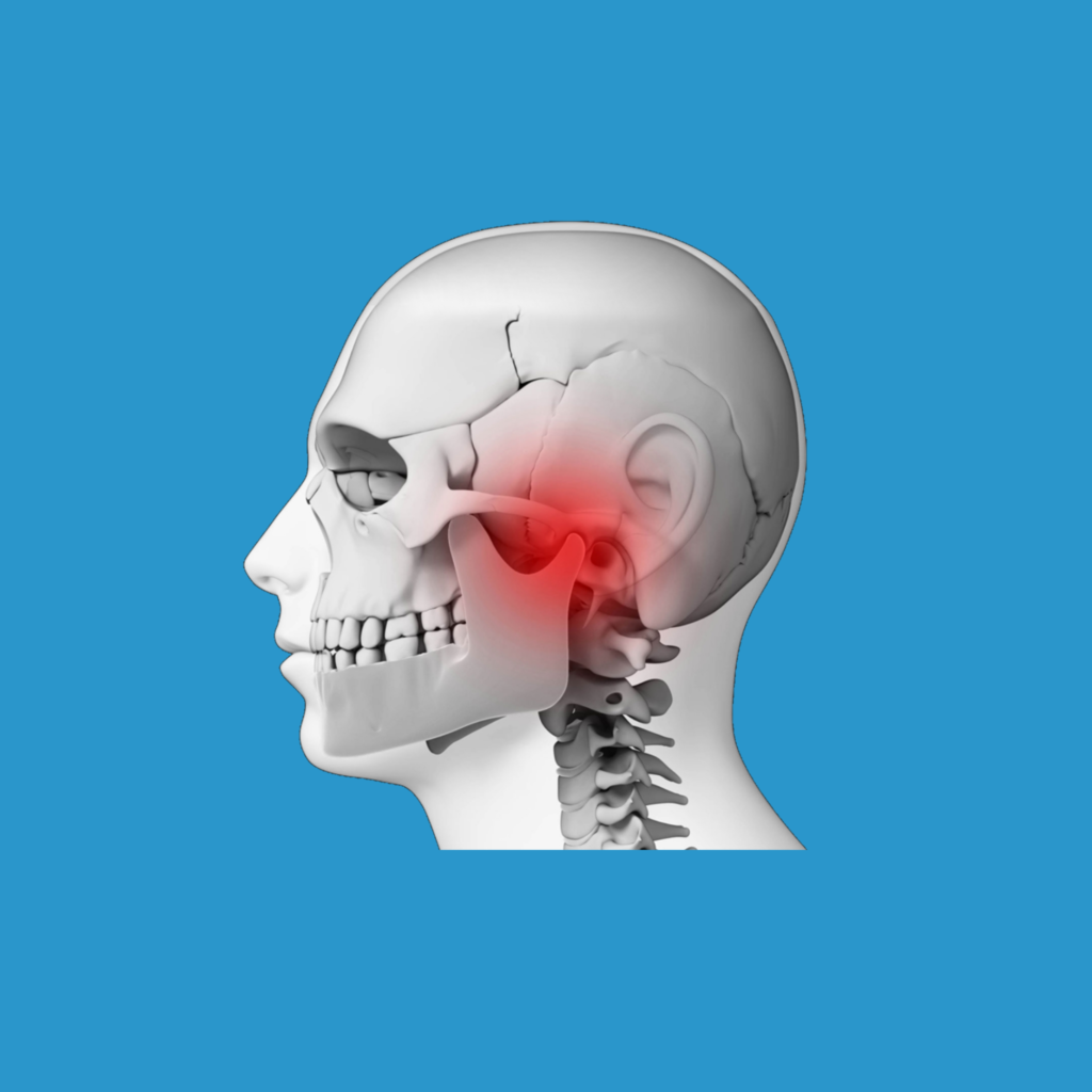 Disfunção Temporomandibular e Dor Orofacial / Bruxismo Virna Patusco